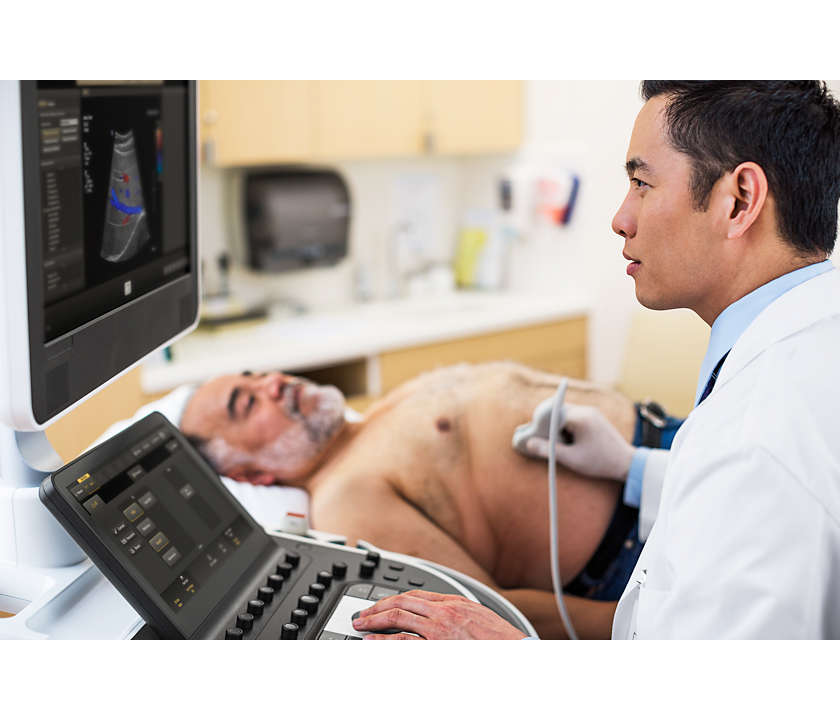 Philips Affiniti 50 Ultraschallsystem