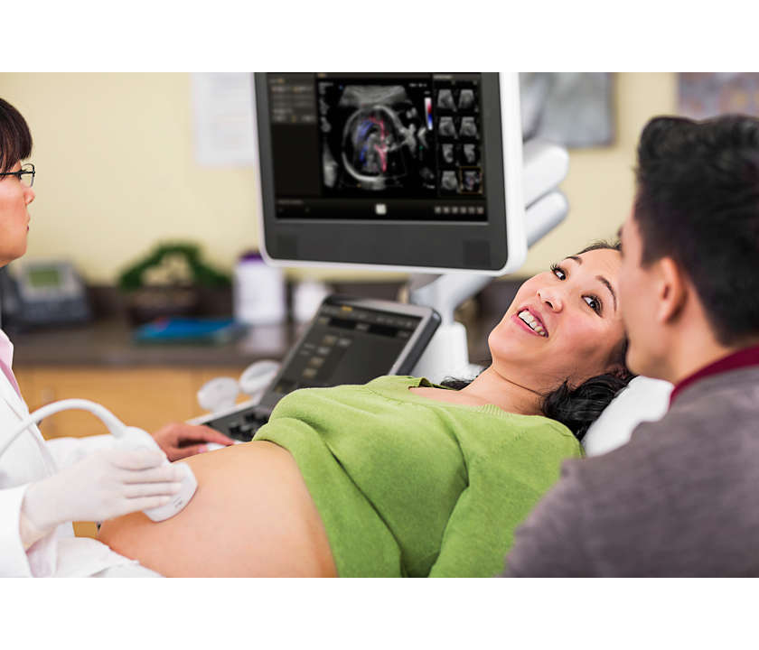 Philips Affiniti 70 Ultraschallsystem