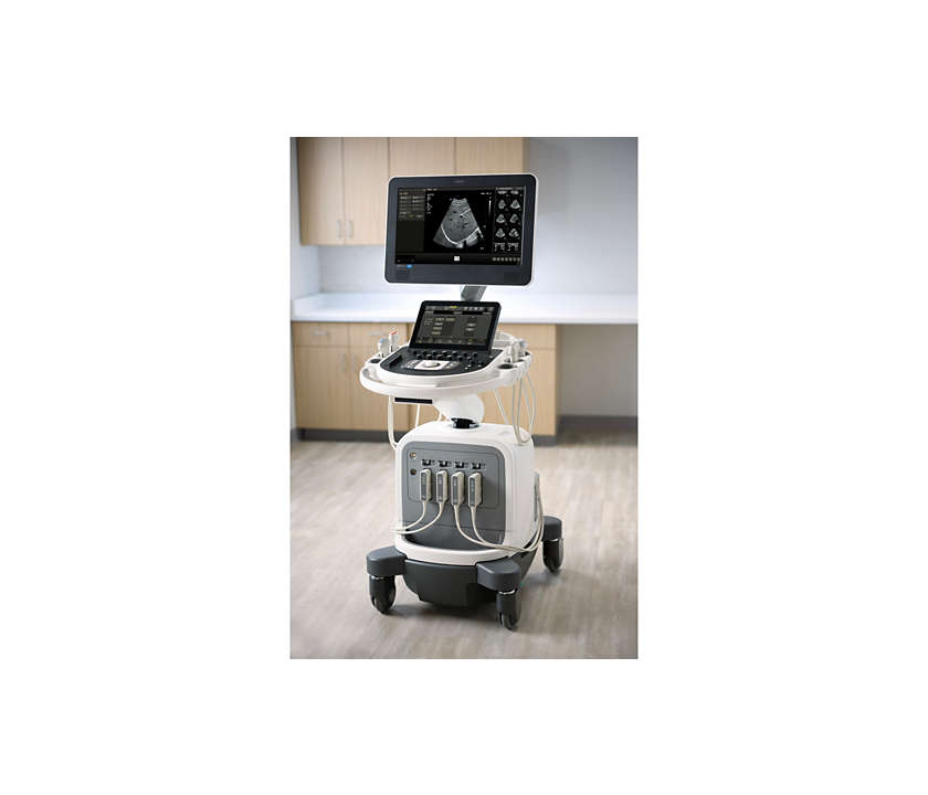 Philips Affiniti 70 Ultraschallsystem